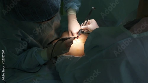 cosmetic breast surgery, Dr. cauterize blood vessels prior to installation of the implant photo