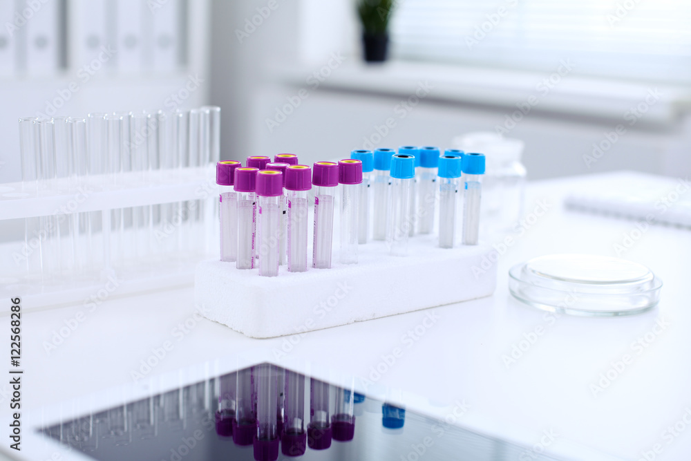 Research laboratory working space. Test tubes and tablet PC are lying at the table. Medical equipment. Blood test Research laboratory working space. Test tubes and tablet PC are lying at the table. Medical equipment. Blood test