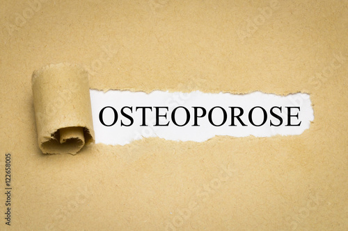 Osteoporose photo