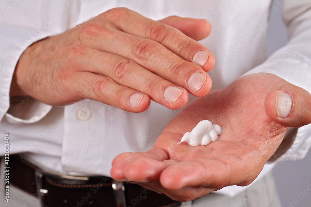 Man applying moisturizer cream on hands, dry skin. Dermatology, cold weather skin care concept Man applying moisturizer cream on hands, dry skin. Dermatology, cold weather skin care concept