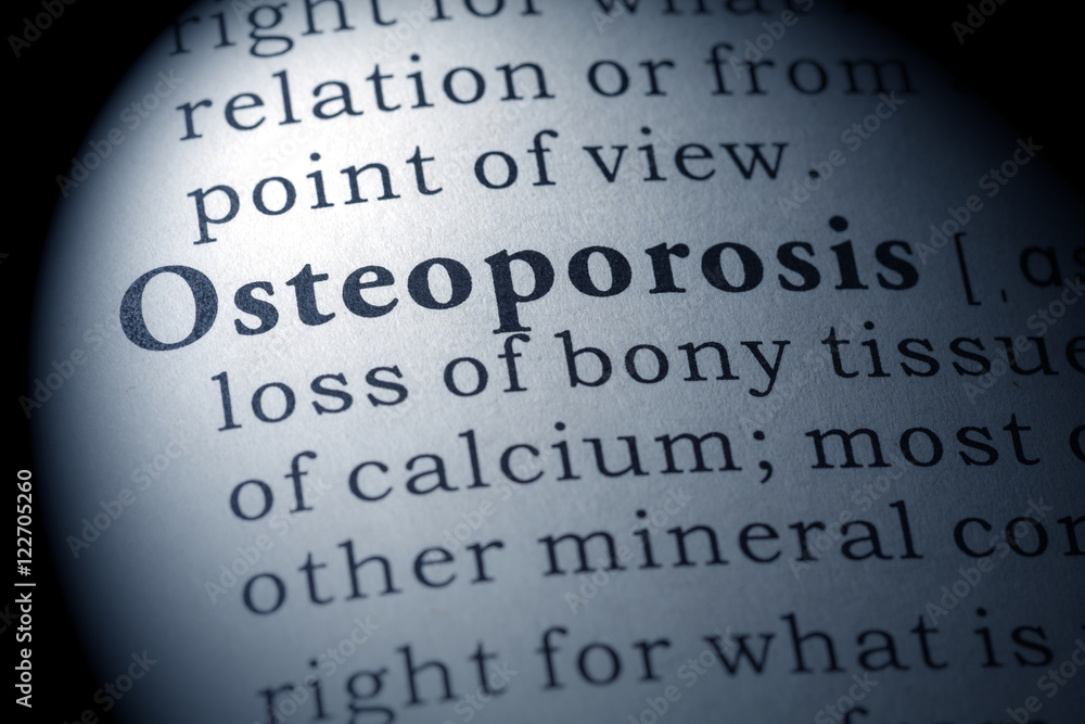 Dictionary definition of osteoporosis Dictionary definition of osteoporosis