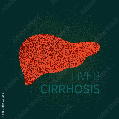 Liver cirrhosis disease design template. Human body organs anatomy icon. Human internal organ symbol. Medical concept. Vector illustration.