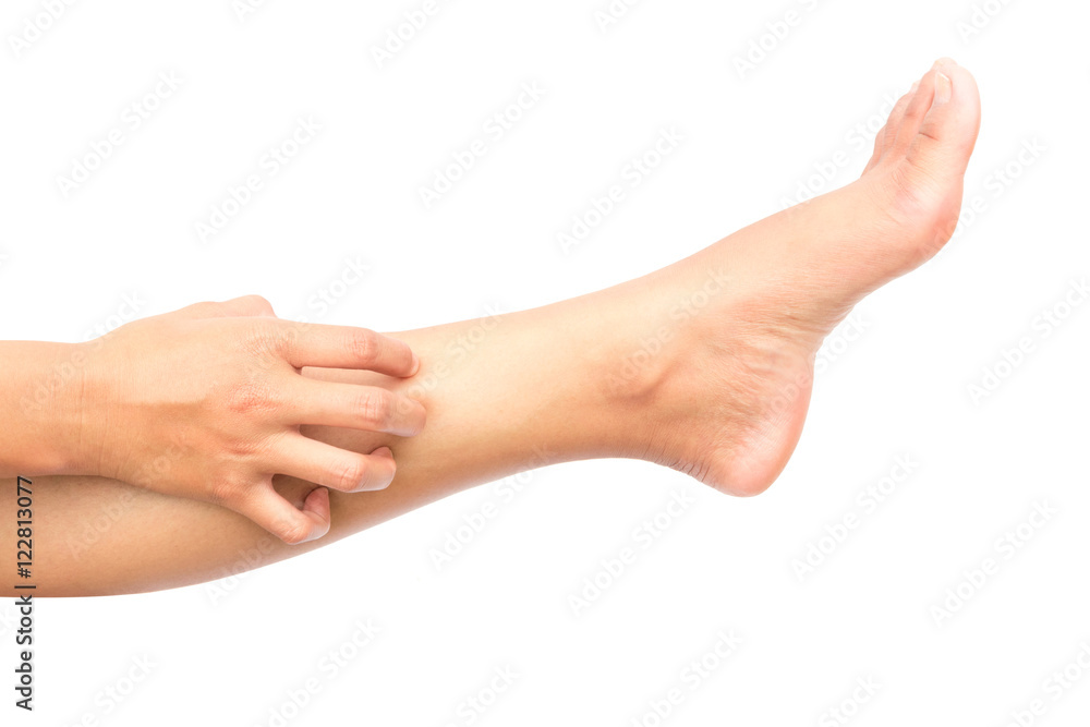 Woman hand scratching on feet with white backgroud for healthy c