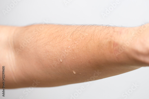 moisture sweat skin, arm with drop of water wet after sport.