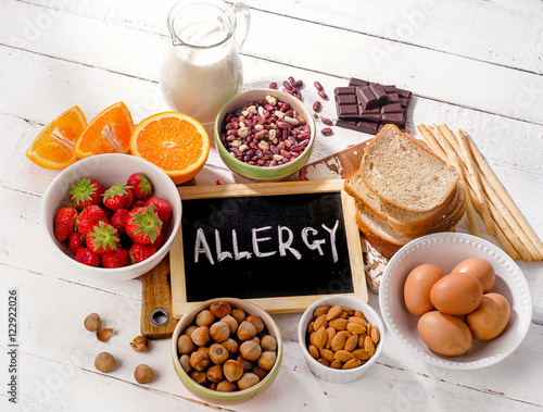 Food allergy. Allergic food on  wooden background. photo
