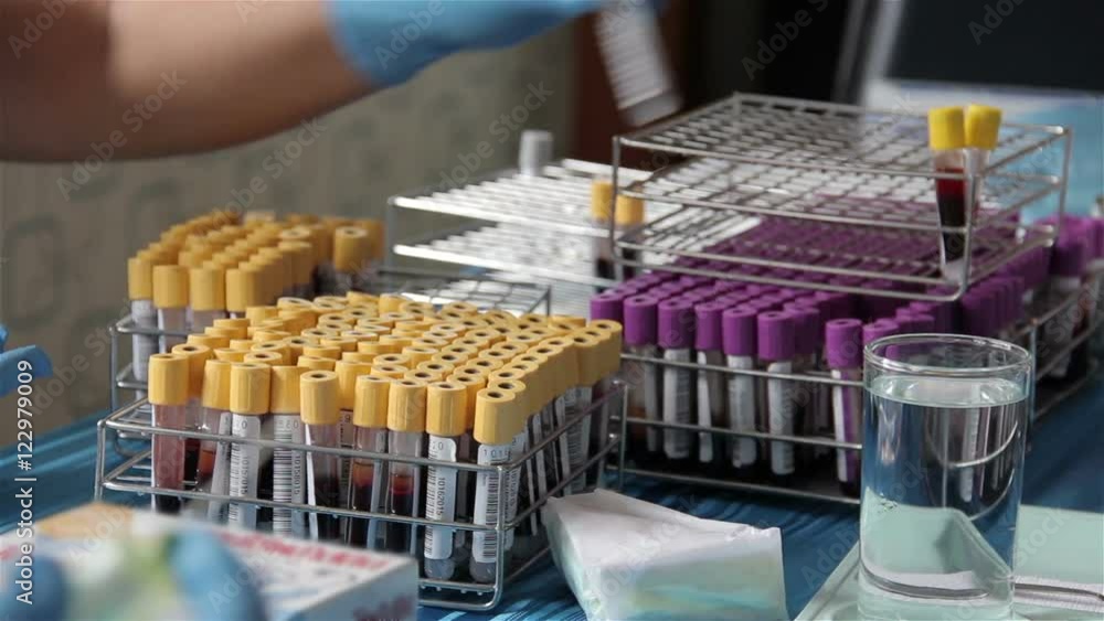 Local health authorities of the blood sample to check for any abnormalities of the year in Bangkok City Local health authorities of the blood sample to check for any abnormalities of the year in Bangkok City