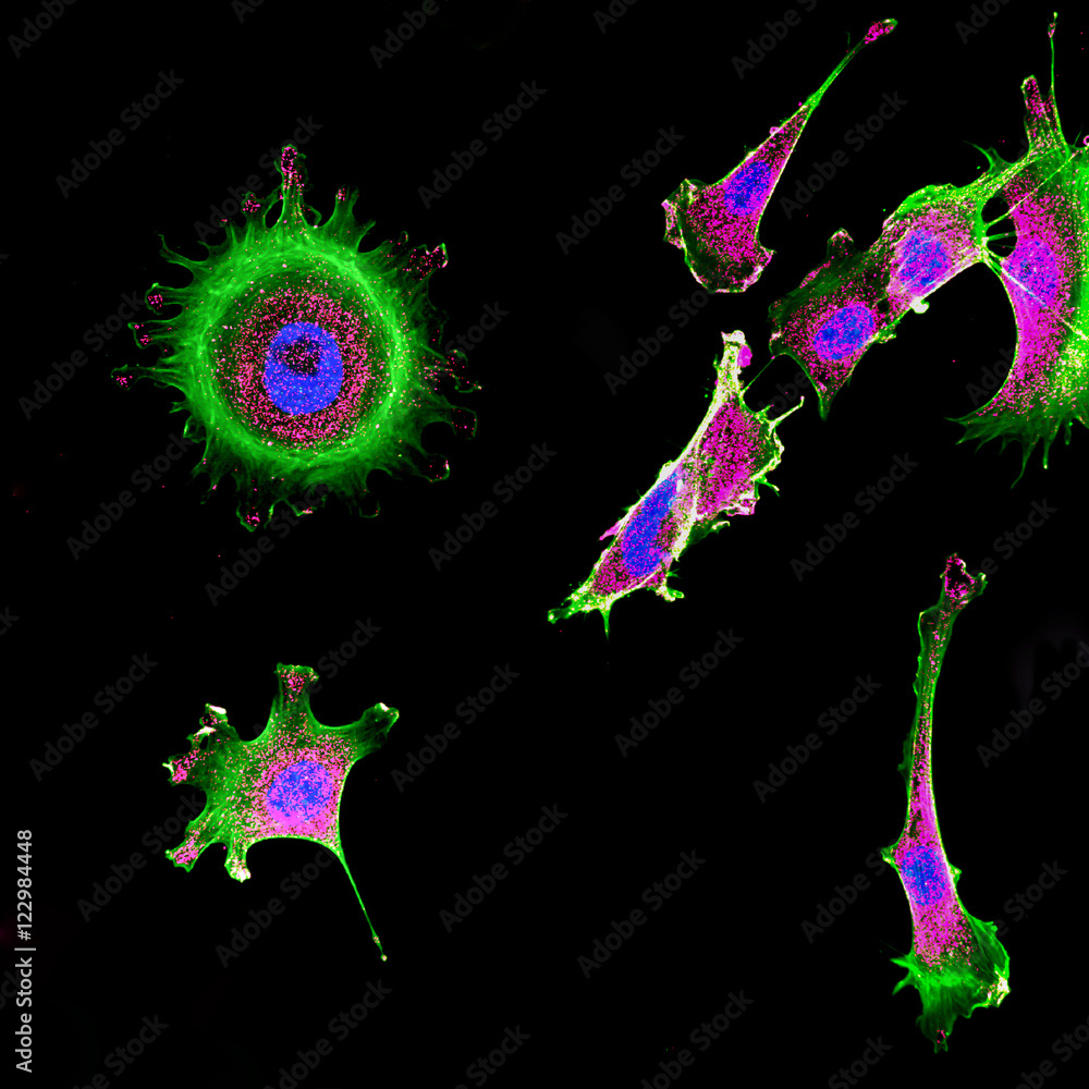 Immunofluorescence of multiple tumor cells grown in tissue culture