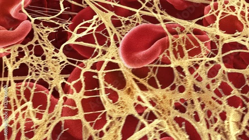 Blood clot, SEM photo