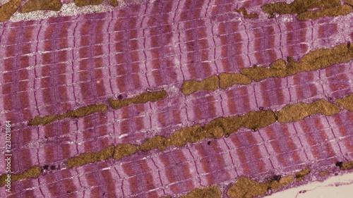 Skeletal muscle fibre, TEM photo