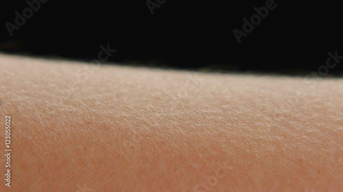 Goosebumps on skin photo