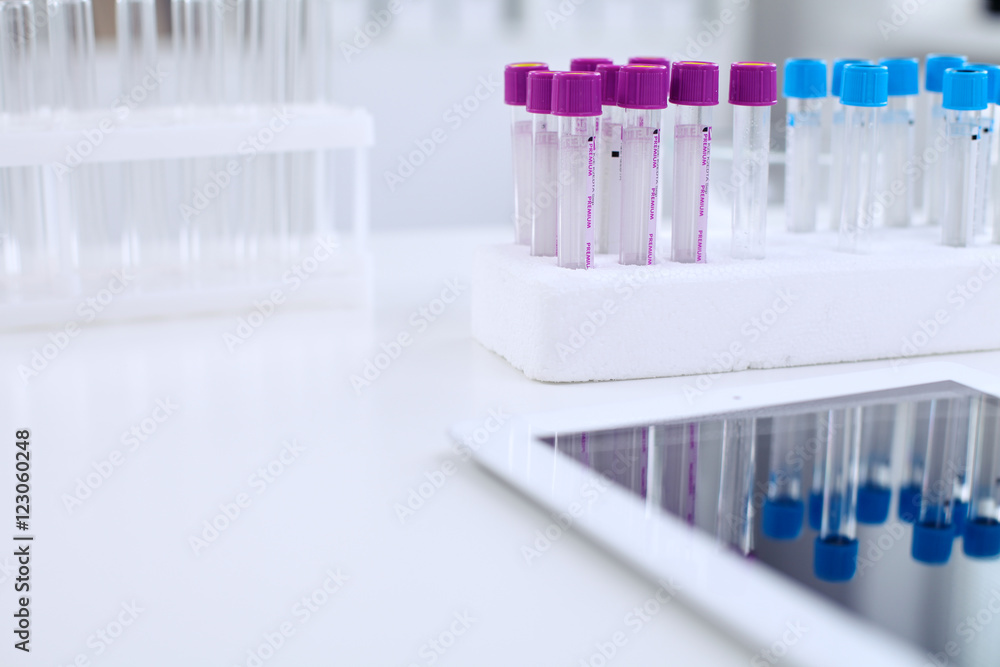 Research laboratory working space. Test tubes and tablet PC are lying at the table. Medical equipment. Blood test Research laboratory working space. Test tubes and tablet PC are lying at the table. Medical equipment. Blood test