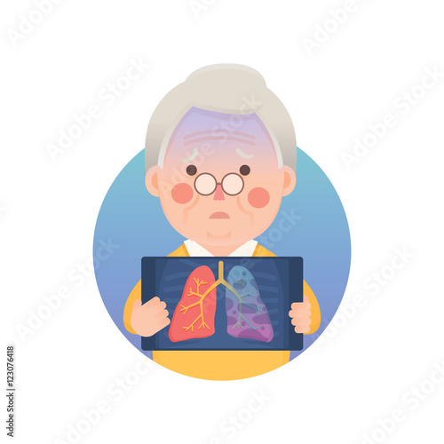 Vector Illustration of Old Man Holding X-ray Image Showing Lung Cancer Problem, Cartoon Character
