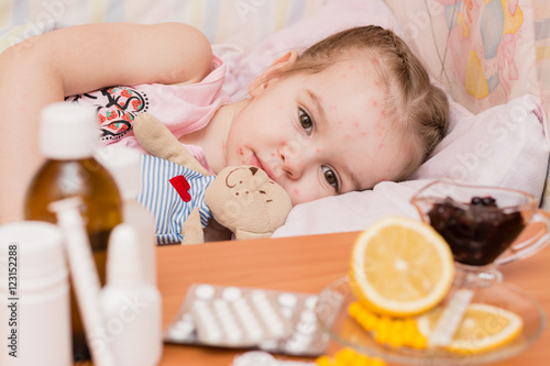 Ребенок в кровати, болеющий ветрянкой, и лекарства перед ним на столе