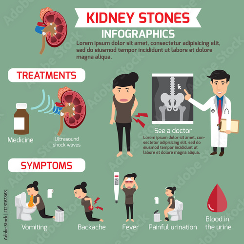Treatment and symptoms of kidney infographics. vector illustrati