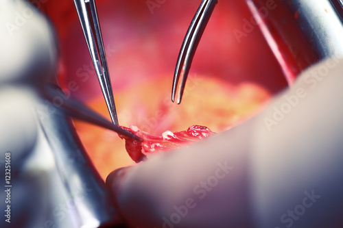 Fotografie Operating hands of doctors, cardiac surgery