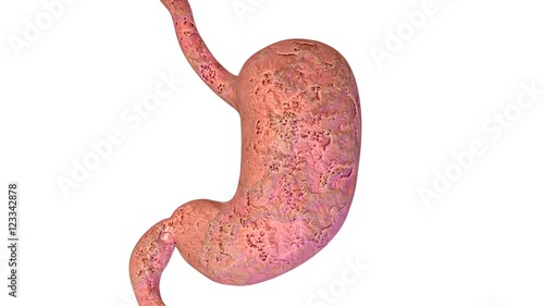 3d rendered medically accurate illustration of Stomach anatomy