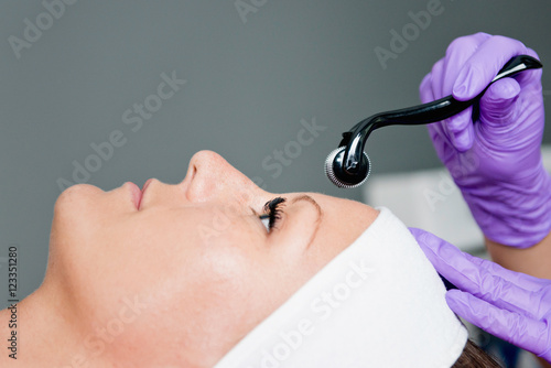 Collagen induction therapy photo