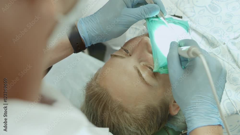 Dentist puts a seal on the aching tooth to the patient Dentist puts a seal on the aching tooth to the patient