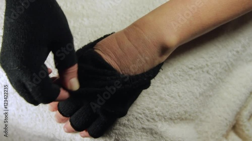 Woman Hands With Gloves, Revealing Severe Allergies To Cold, Red And Itchy Skin