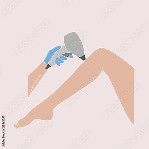 laser hair removal