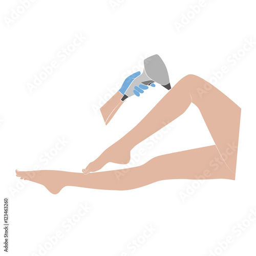 laser hair removal