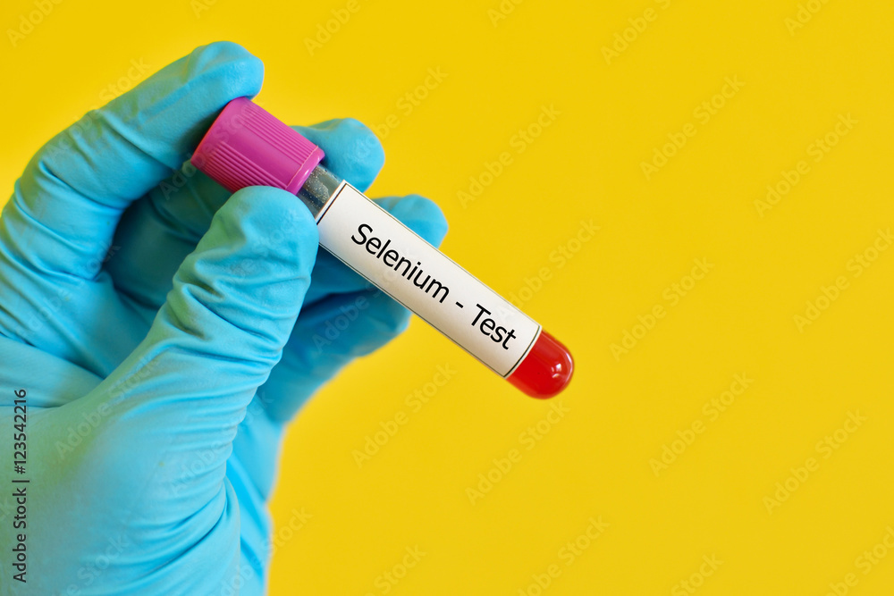 Blood sample for selenium test Stock Photo Adobe Stock