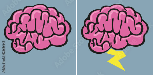 Brainstorming - Cerveau