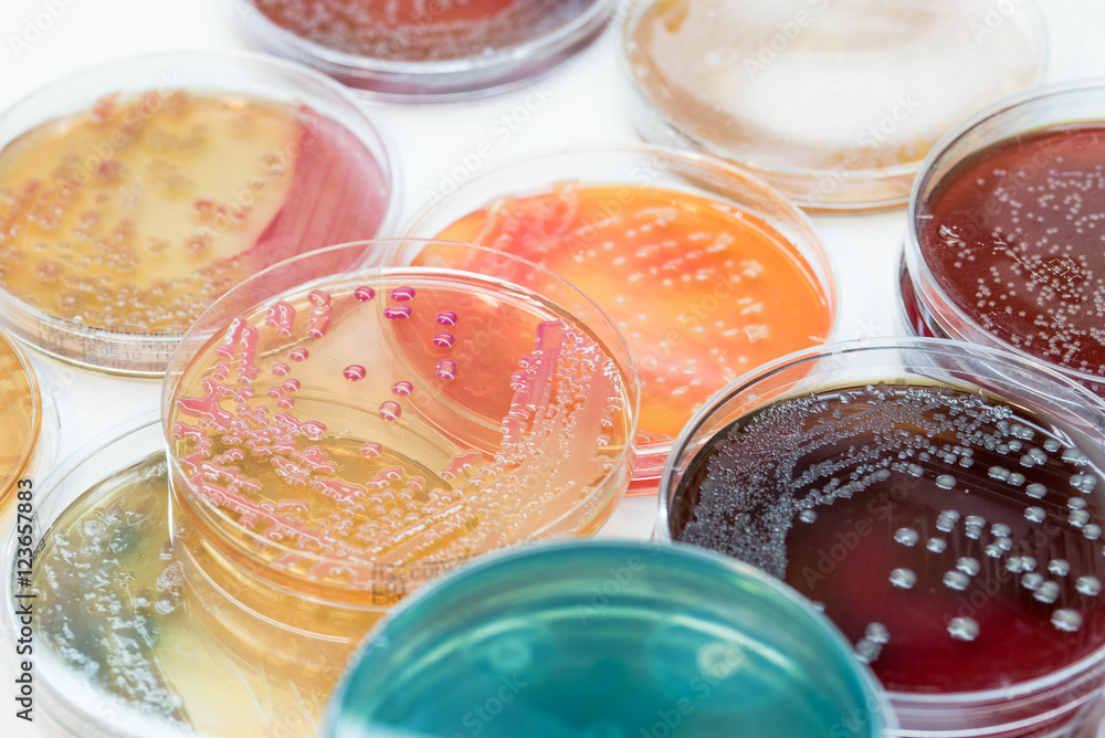 Bacterial colonies culture growth on selective media. Bacterial colonies culture growth on selective media.
