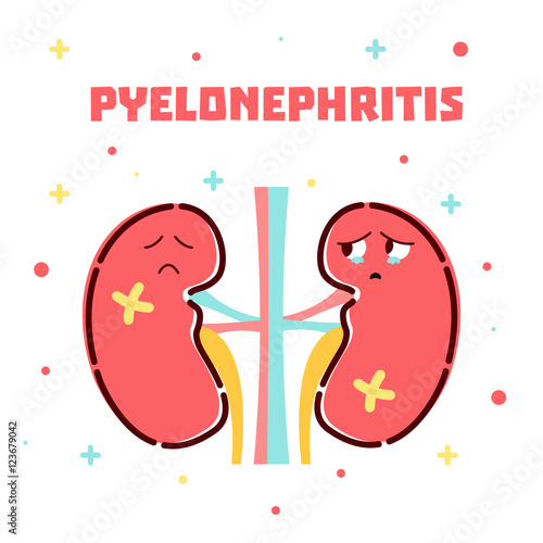 Pyelonephritis disease awareness poster with sad cartoon kidneys character on white background. Urinary tract infection. Human body organs anatomy icon. Medical concept. Vector illustration.