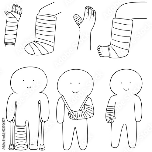 vector set of orthopedic cast