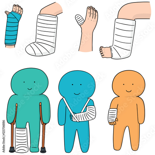 vector set of orthopedic cast