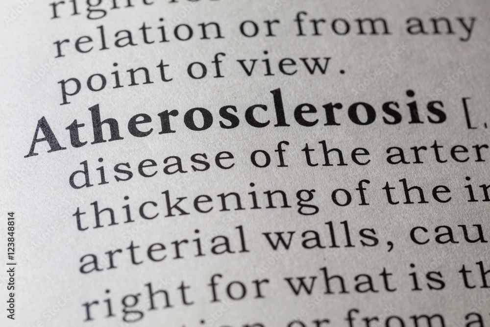 Dictionary definition of atherosclerosis Dictionary definition of atherosclerosis