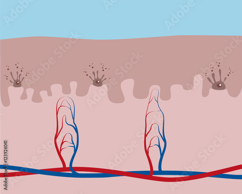 A cross section of human skin, epidermis and dermis, with melanocytes.