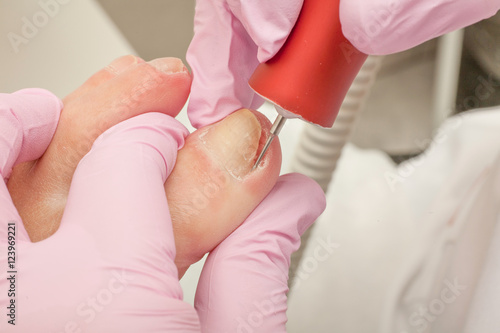 Doctor Podiatry removes calluses, corns and treats ingrown nail. Hardware manicure. Concept body care. 