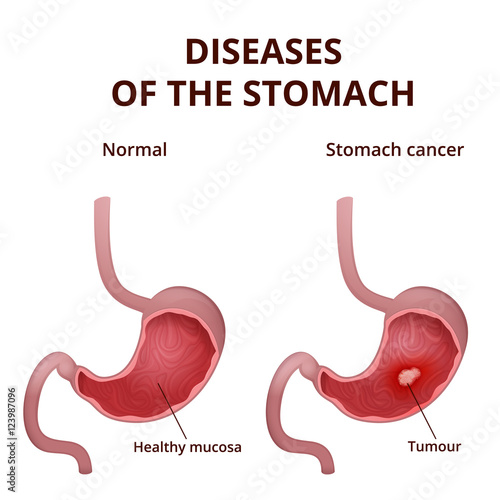 Anatomy of the human stomach