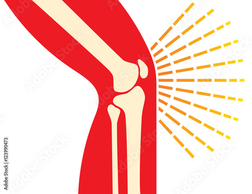 knee joint bones - pain icon (orthopedic clinics design)