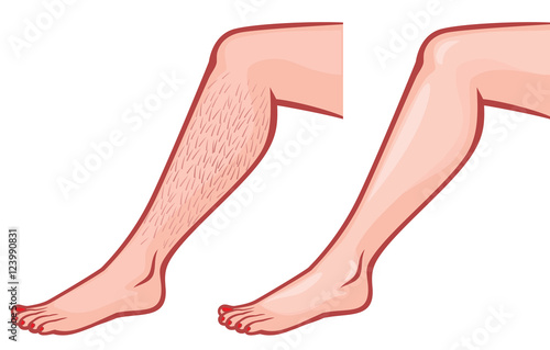 woman legs before and after depilation