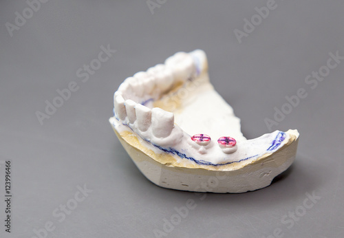 Technical shots on a dental prothetic laboratory photo