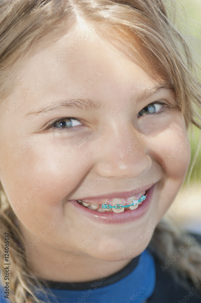 Portrait Of A Girl With Braces; Lake Tahoe, California, United States of America Portrait Of A Girl With Braces; Lake Tahoe, California, United States of America