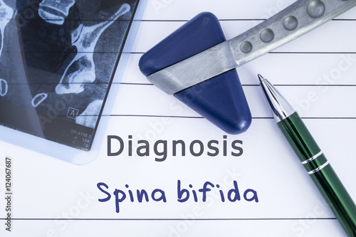 Diagnosis spina bifida. Medical health history written with diagnosis of spina bifida, MRI image sacral spine and neurological hammer. Medical concept for Neurology, Neuroscience  photo