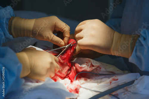Fotografi Close up of operation on bodies