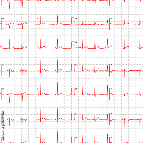 Electrocardiogram red graph with marks on white, seamless pattern