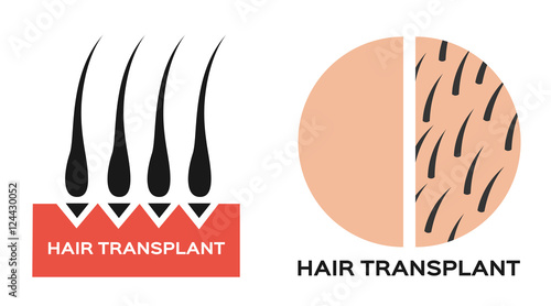 hair transplantation icon logo and vector , black hair
