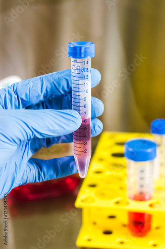 Scientist examining test tube containing growth medium