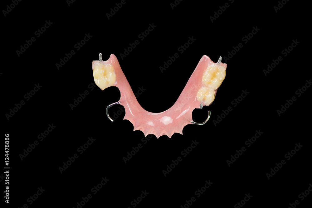 Acrylic partial denture provisional prosthesis Stock Photo Adobe Stock