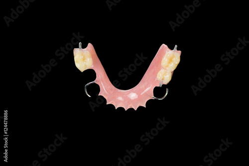 Acrylic partial denture - provisional prosthesis