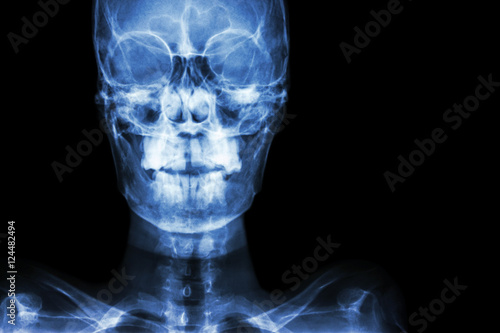 normal human's skull and blank area at right side