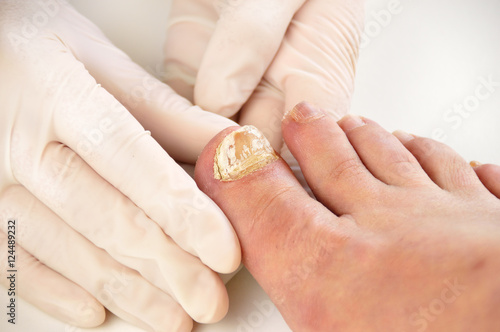 Fotografie checking the disease big toe