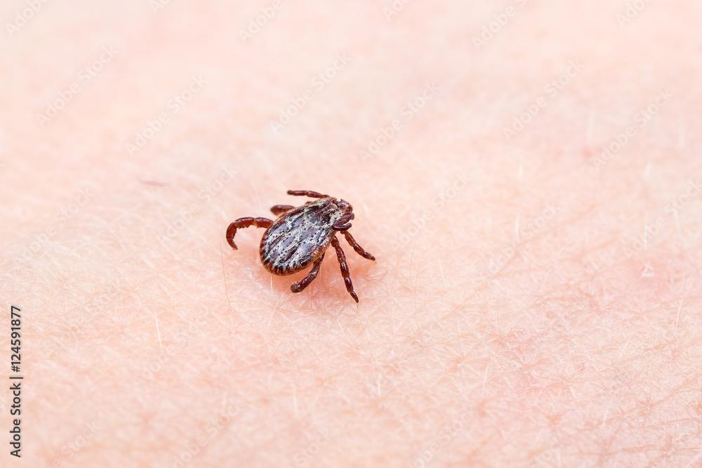 wood tick wood tick