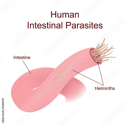 Illustration of internal human parasites
